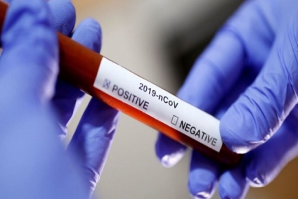 من بينها 38 محلية: تسجيل 42 &nbsp;إصابة جديدة بكورونا في تونس