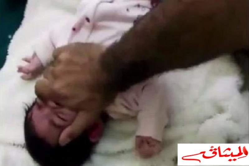 السلطات السعودية تلقي القبض على أب عذب ابنته الرضيعة