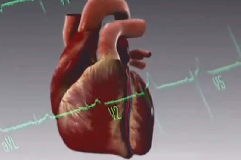 دراسة:نصف نوبات القلب صامتة و بلا أعراض