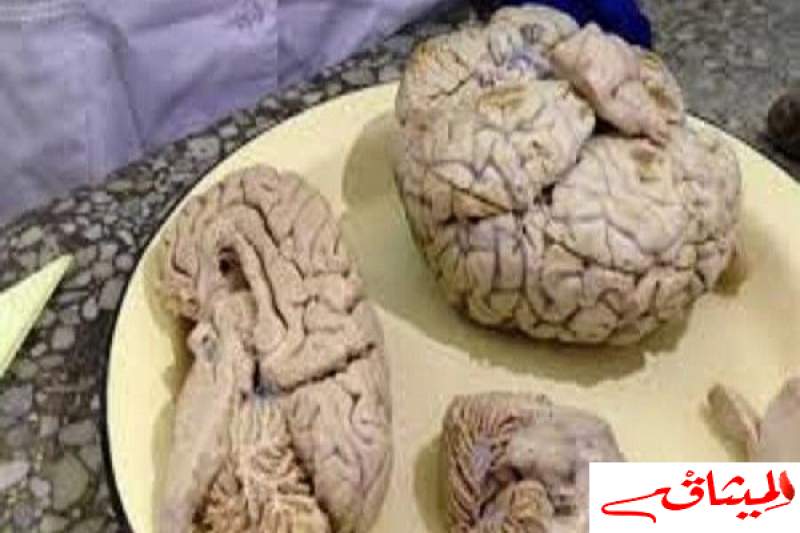 العلماء يحددون مركز التسامح في دماغ الإنسان