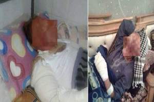 مستشفى بنزرت:طردوا نزلاء بسبب رائحة الحروق على وجوههم!!!