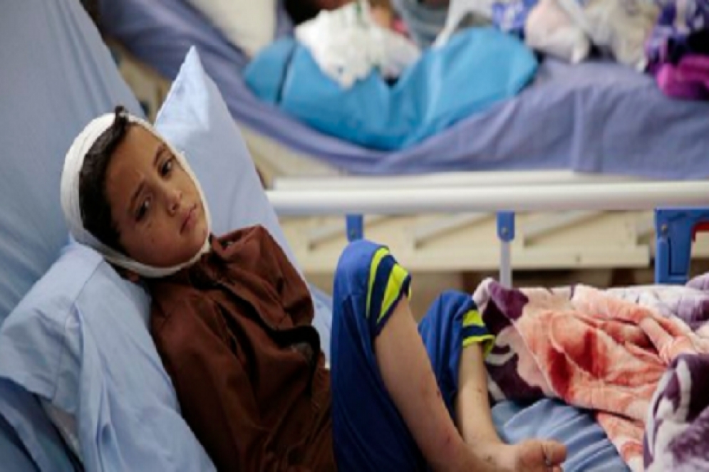الجوع يهدد مليون طفل إضافي في اليمن