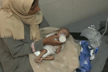 دراسة: أكثر من 54 ألف طفل في غزة يعانون من سوء تغذية حاد