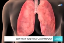  تعرف على فوائد الصيام لمرضى الجهاز التنفسي (فيديو)