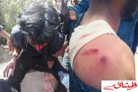 الجيلاني الهمامي:الاعتداء على طلبة الحقوق "وحشي ومنافي للقانون"